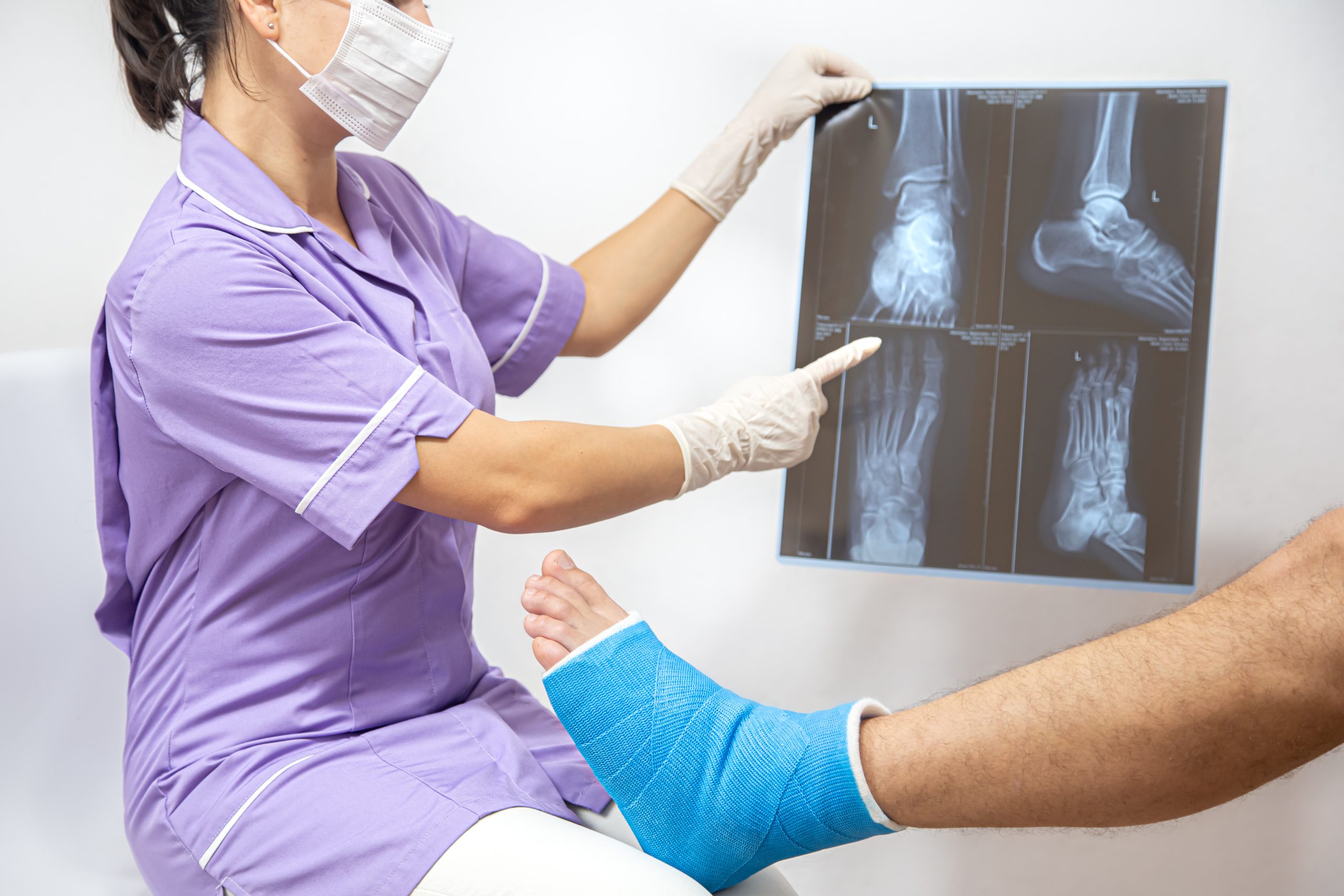 Bone fracture foot and leg on male patient being examined by a woman doctor in a hospital. Female doctor in a blue medical gown checking broken leg and shows the male patient lateral projection x-ray of foot and ankle.